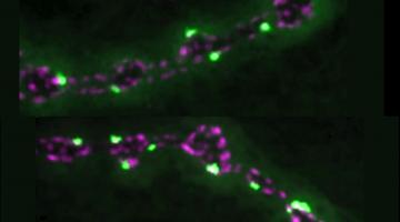 MIT researchers have found that a protein called SYT7 appears to limit activity at neural connections called synapses. Here, synapses glowing light green are engaged in neurotransmitter release. Photo: Littleton Lab/Picower Institute