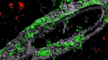 In Alzheimer's disease, the blood-brain barrier can become disrupted by the accumulation of amyloid protein, especially in people who carry a genetic variant called APOE4. This 3D rendering of an APOE4-carrying engineered blood vessel shows heav...