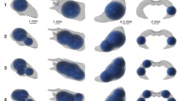 3D renderings of simulated multi-bolus delivery to various brain structures (striatum, amygdala, substantia nigra, and hippocampus) show one to four boluses.Image courtesy of the Graybiel, Cima, and Langer labs.