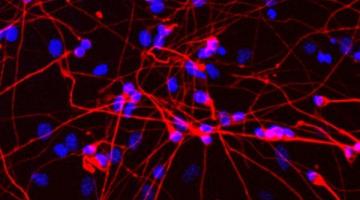 Immunofluorescence microscopy of MeCP2 neurons derived from mouse embryonic stem cellsImage: Charles Li/Whitehead Institute