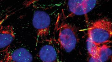 RNA-binding proteins (green) are visible in these hepatocyte carcinoma cells. The cell nuclei are labeled blue, and actin proteins are labeled red.Credit: Éric Lécuyer