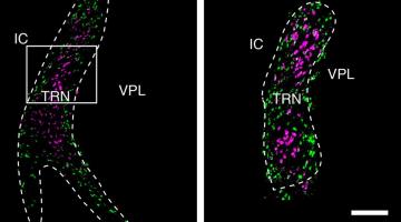 These cross-sections of the thalamic reticular nucleus (TRN) show two distinct populations of neurons, labeled in purple and green. A team of researchers from MIT and the Broad Institute of MIT and Harvard has now mapped the TRN in unprecedente...