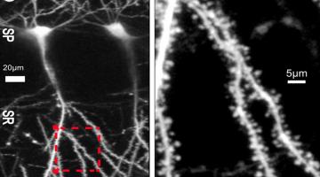 Within a microscope image of neurons from the hippocampus region of a rodent brain (left), a zoomed-in section (red square) of a neuron's dendrites shows spines (right) where many synaptic connections with other neurons reside. Image: Stephanie Barnes